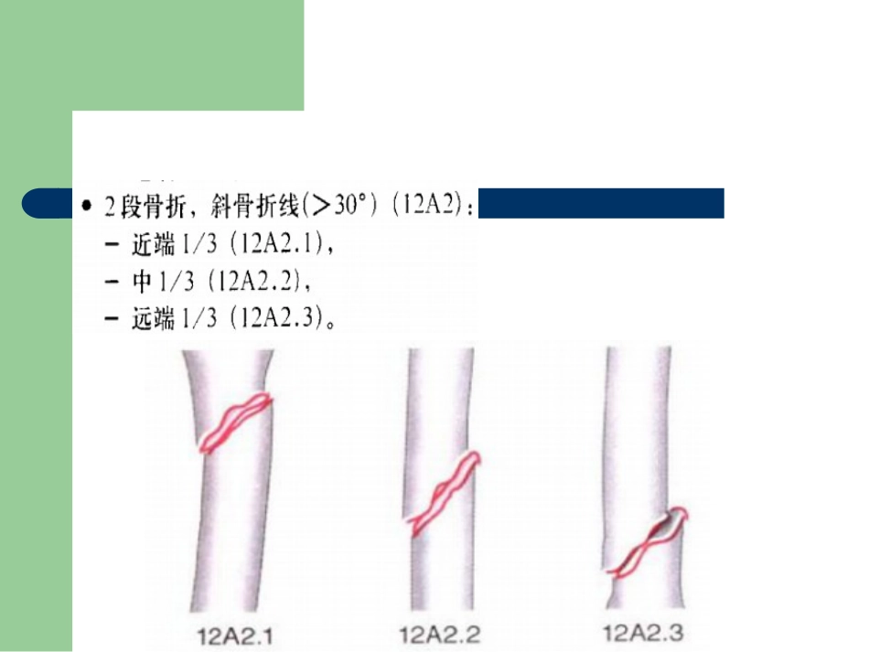 外科学：骨折分型_第9页