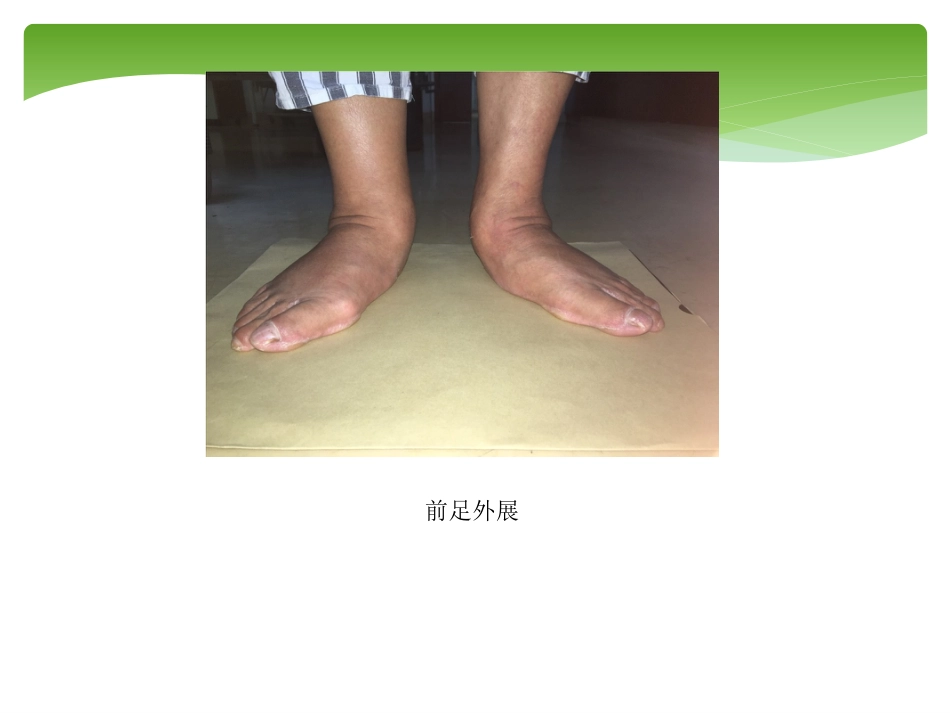 外科学：胫后肌腱功能不全的诊治_第15页