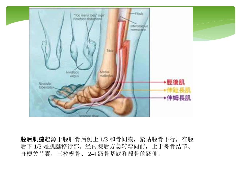 外科学：胫后肌腱功能不全的诊治_第3页