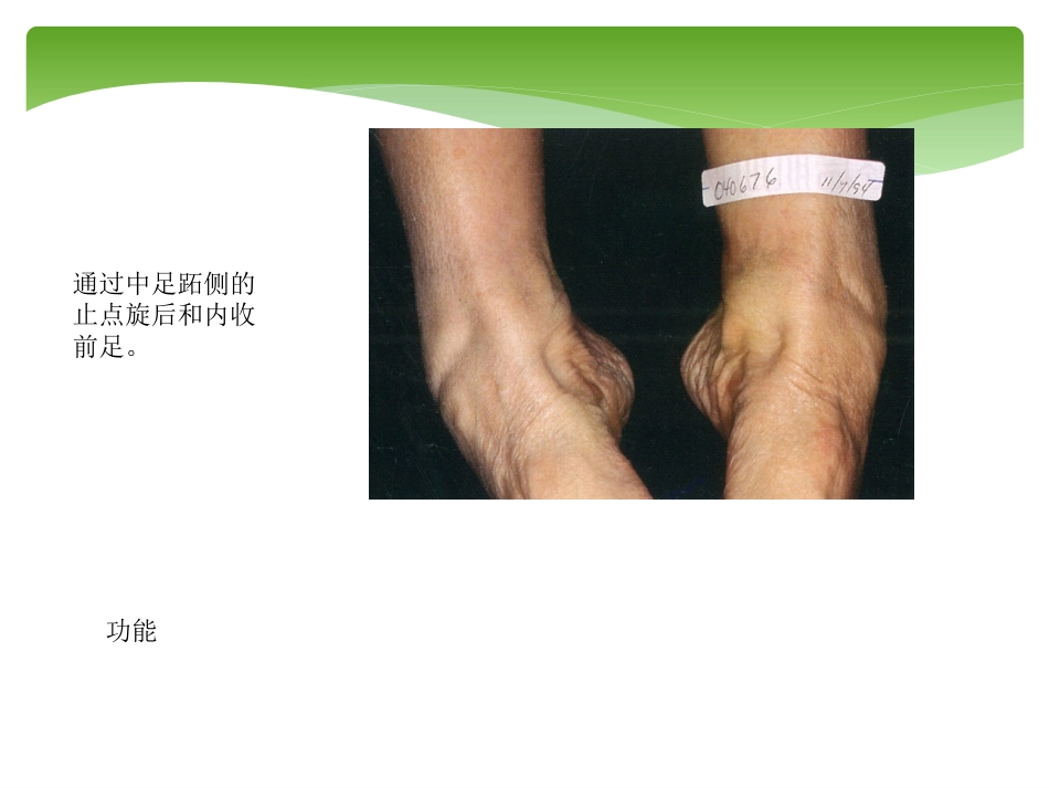 外科学：胫后肌腱功能不全的诊治_第7页