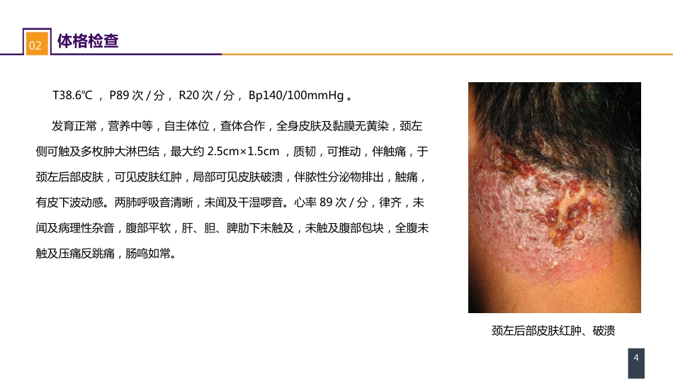 外科学：案例分析-痈_第4页