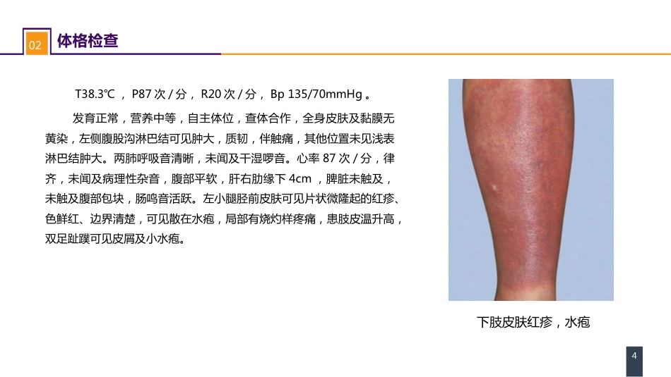 外科学：案例分析-丹毒_第4页