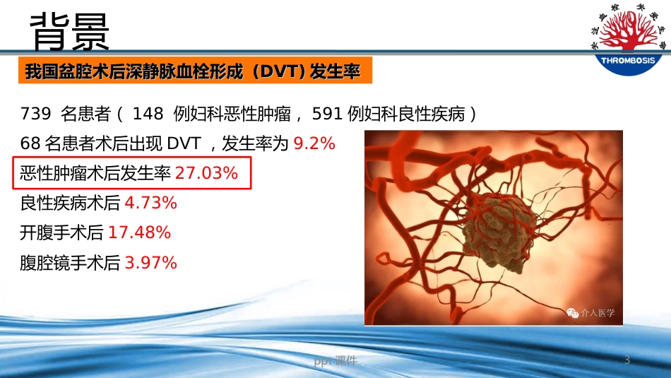 VTE预防与管理--ppt课件_第3页