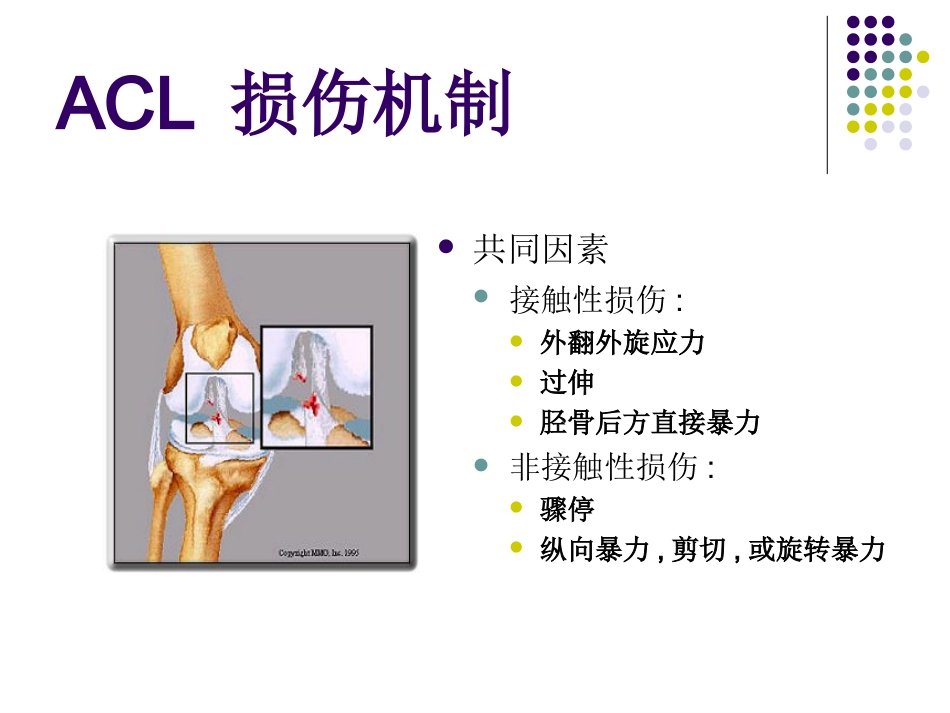 外科学：膝关节前交叉韧带损伤诊断与治疗_第3页
