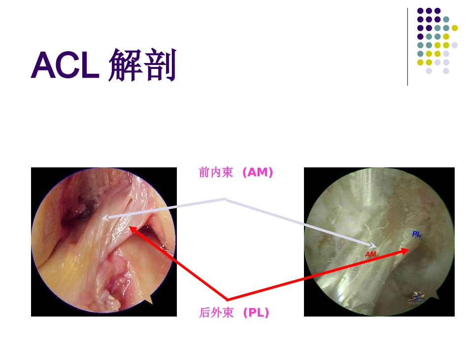 外科学：膝关节前交叉韧带损伤诊断与治疗_第4页