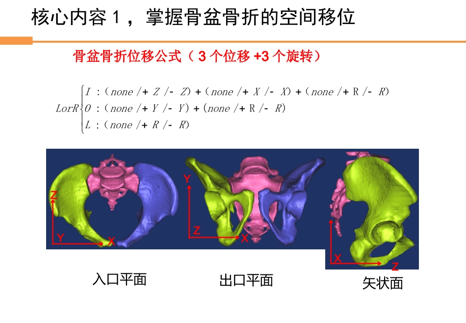 外科学：骨盆骨折_第14页