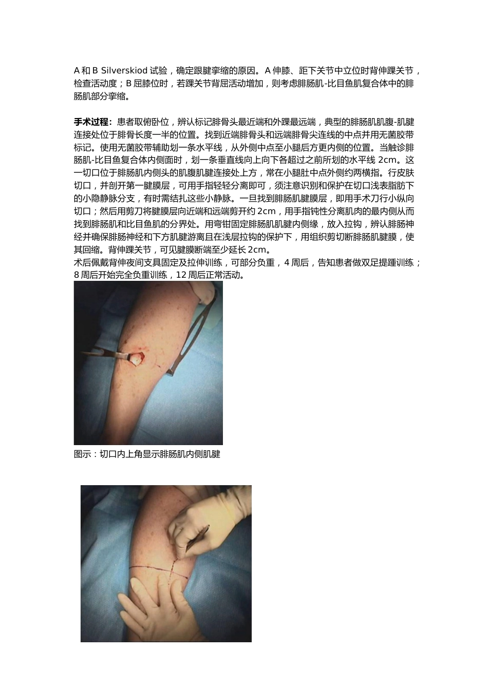 外科学：腓肠肌腱膜松解_第2页