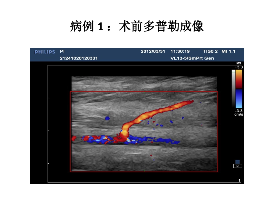 外科学：小腿穿支皮瓣的临床应用_第12页