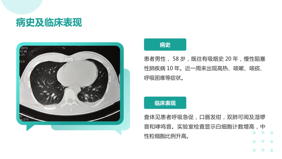 重症肺炎疑难病例讨论ppt_第5页