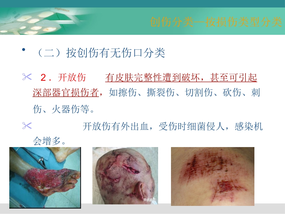《创伤急救》PPT课件_第11页