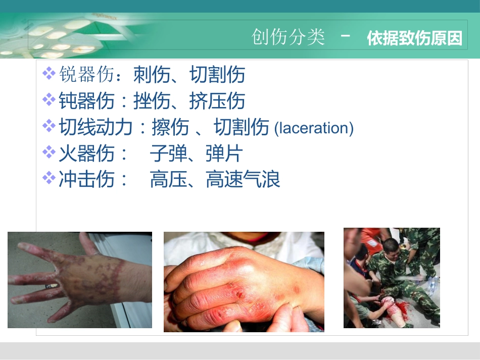 《创伤急救》PPT课件_第9页