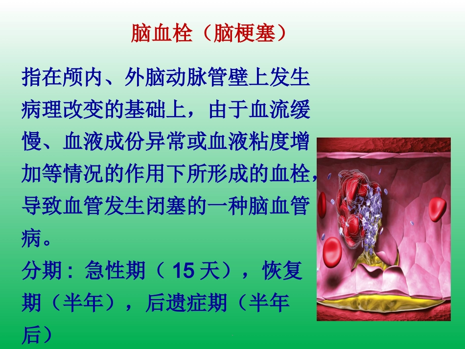 脑卒中的症状识别及院前急救_第14页
