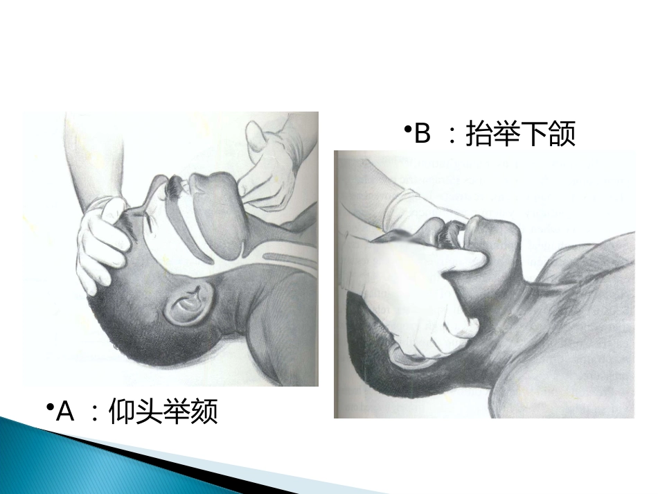 CPR培训(急救技能培训 徒手心肺复苏(成人)操作步骤)_第7页
