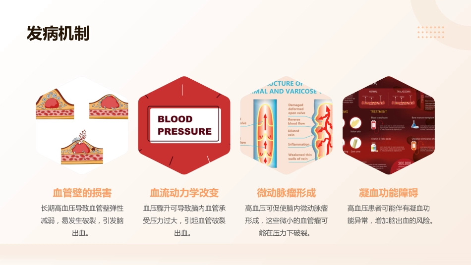 高血压脑出血的急救与护理课件_第5页