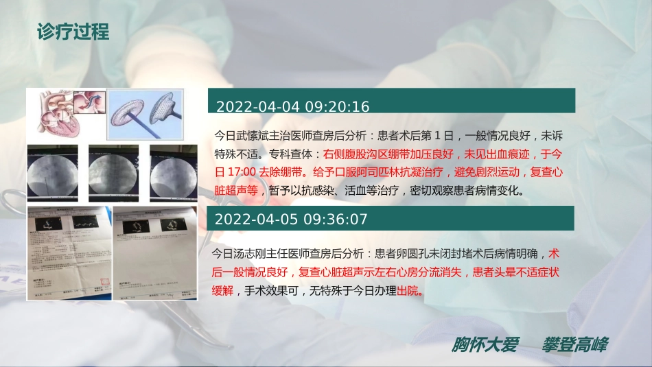 一例卵圆孔未闭患者的个案护理_第13页