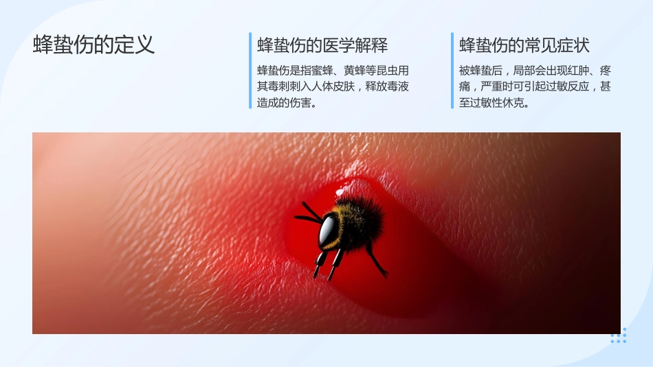 蜂蛰伤的急救与护理_第4页