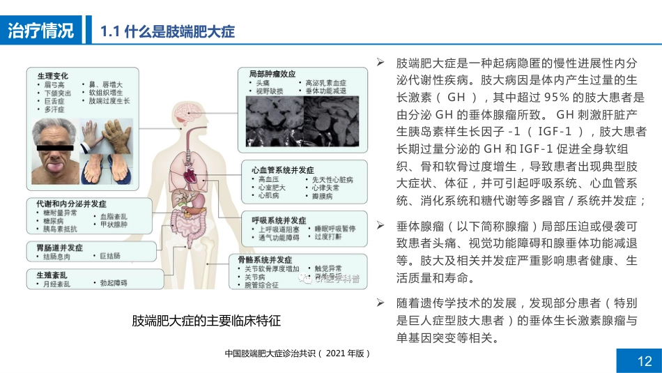 一例肢端肥大症患者的病例讨论_第12页