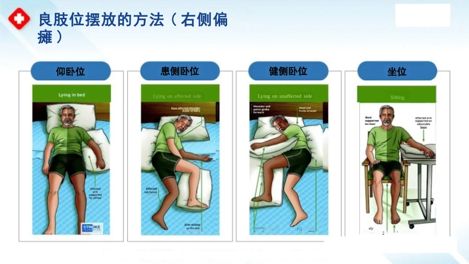 临床脑卒中偏瘫患者良肢位摆放_第10页