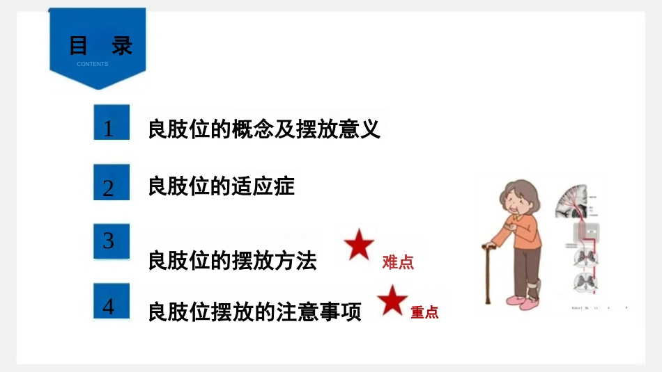 临床脑卒中偏瘫患者良肢位摆放_第3页