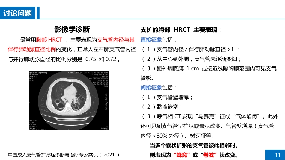 一例支气管扩张合并肺部感染患者病例讨论_第11页