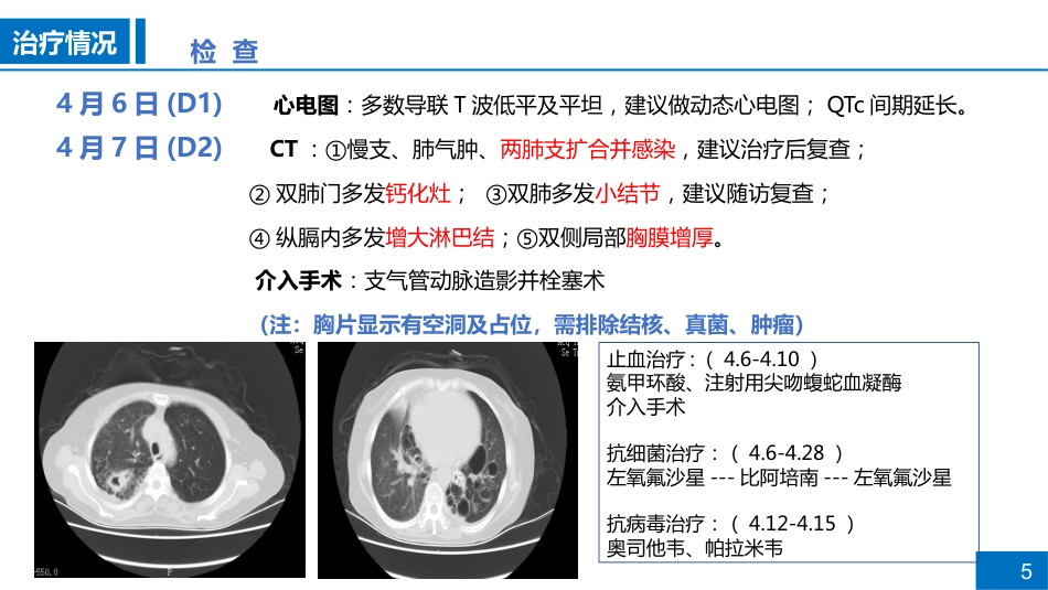 一例支气管扩张合并肺部感染患者病例讨论_第5页