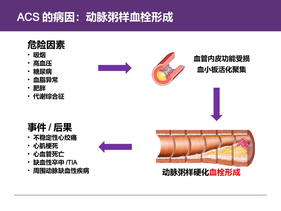 急性冠脉综合征(ACS)患者用药咨询及长期用药管理_第4页