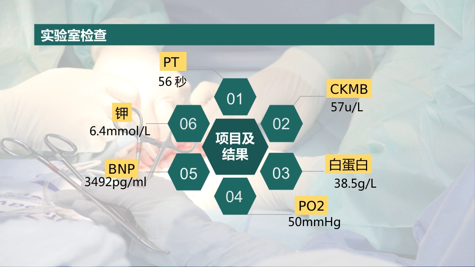 一例冠心病患者综合护理的个案分享_第11页