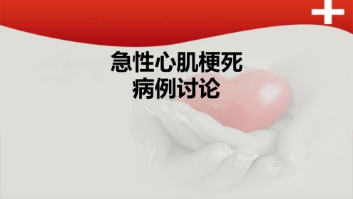 急性心肌梗死病例讨论