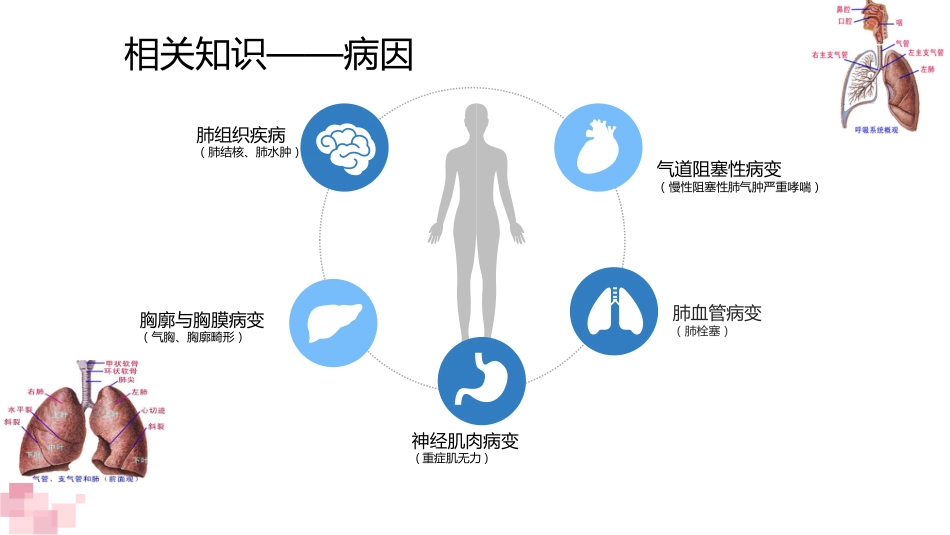 一例重症肺炎并发呼吸衰竭患者的经典案例_第4页