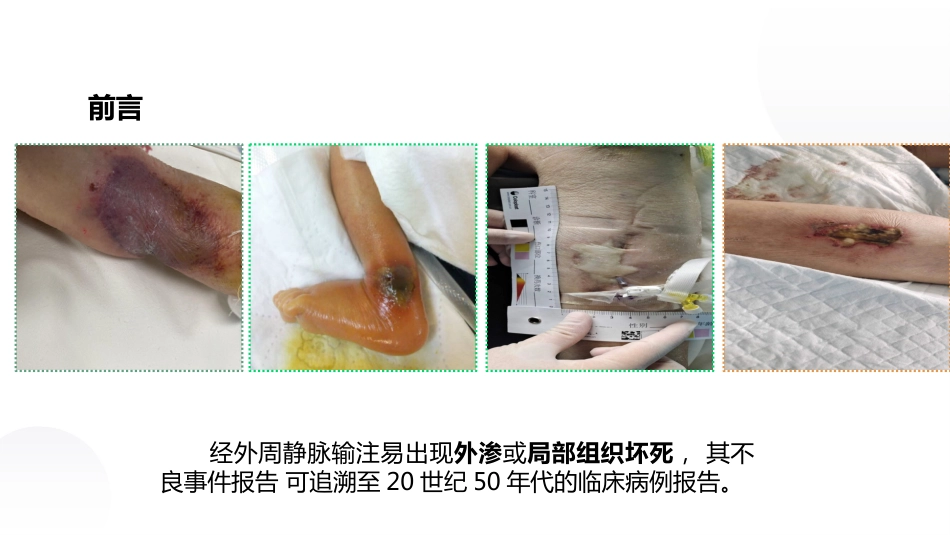 血管活性药物静脉输注护理课件_第3页