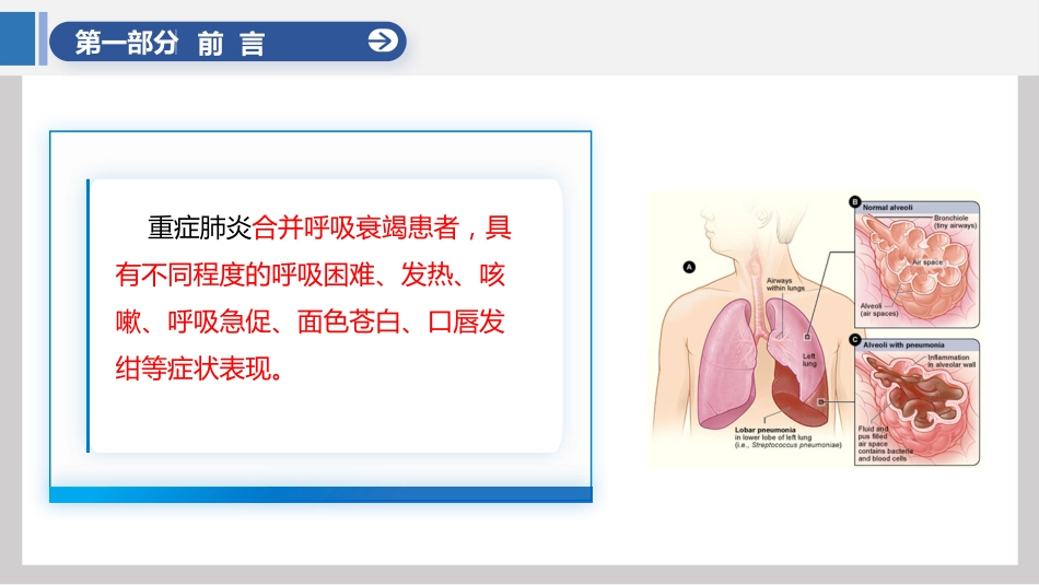 一例重症肺炎合并呼吸衰竭患者的个案护理_第7页