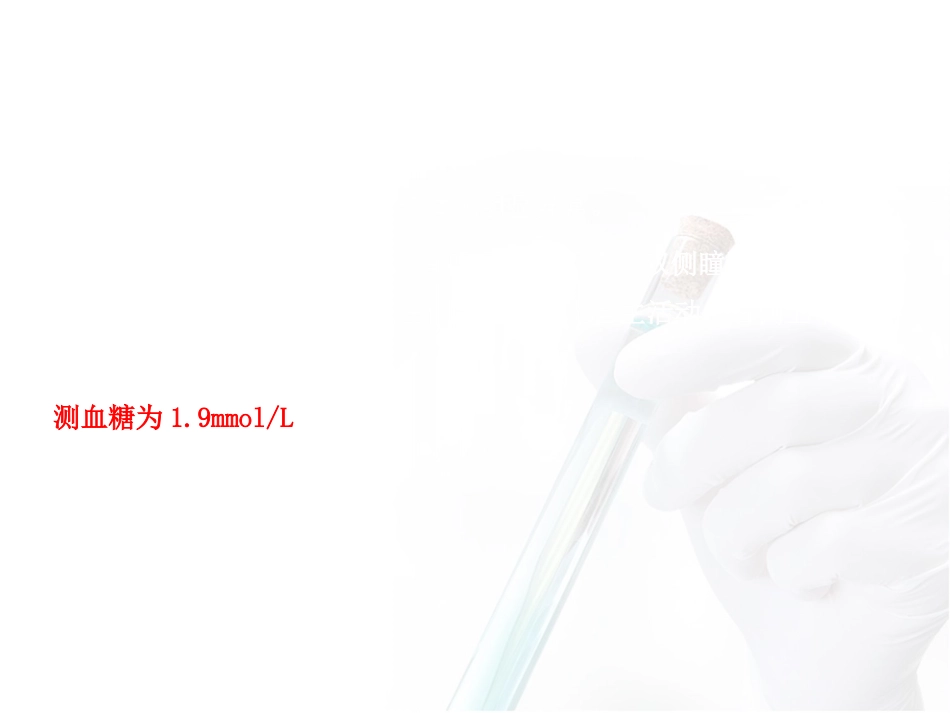 危重患者血糖监测与管理_第4页