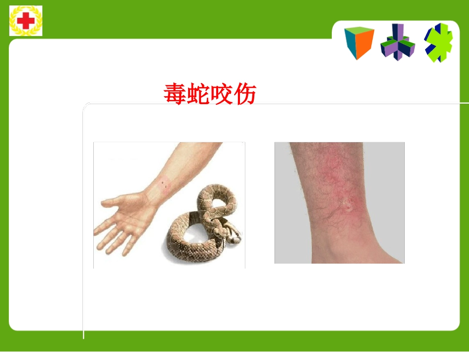 常见动物咬蛰伤应急救护ppt课件_第13页