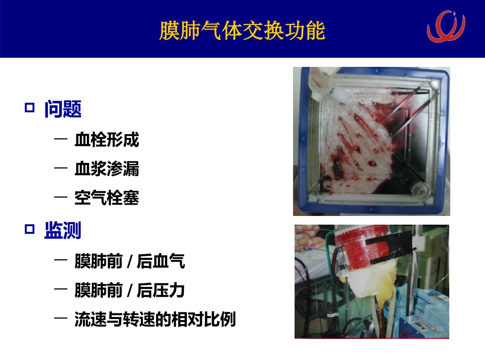 ECMO相关病理生理 呼吸疾病研究所[急救治疗]_第13页