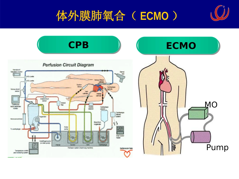 ECMO相关病理生理 呼吸疾病研究所[急救治疗]_第5页