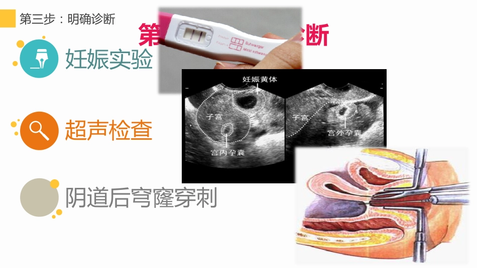 ZX异位妊娠失血性休克急救护理_第15页