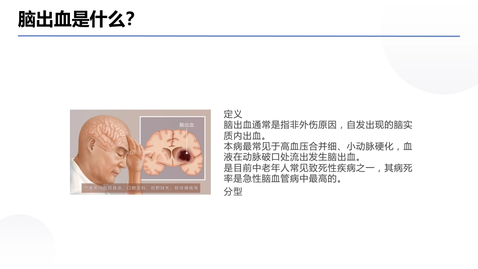 脑出血病例讨论PPT课件01_第3页