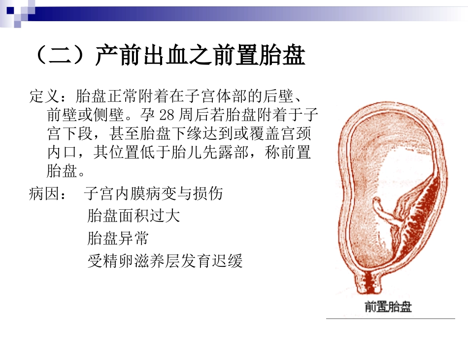 66.产科急救常识复件_第13页