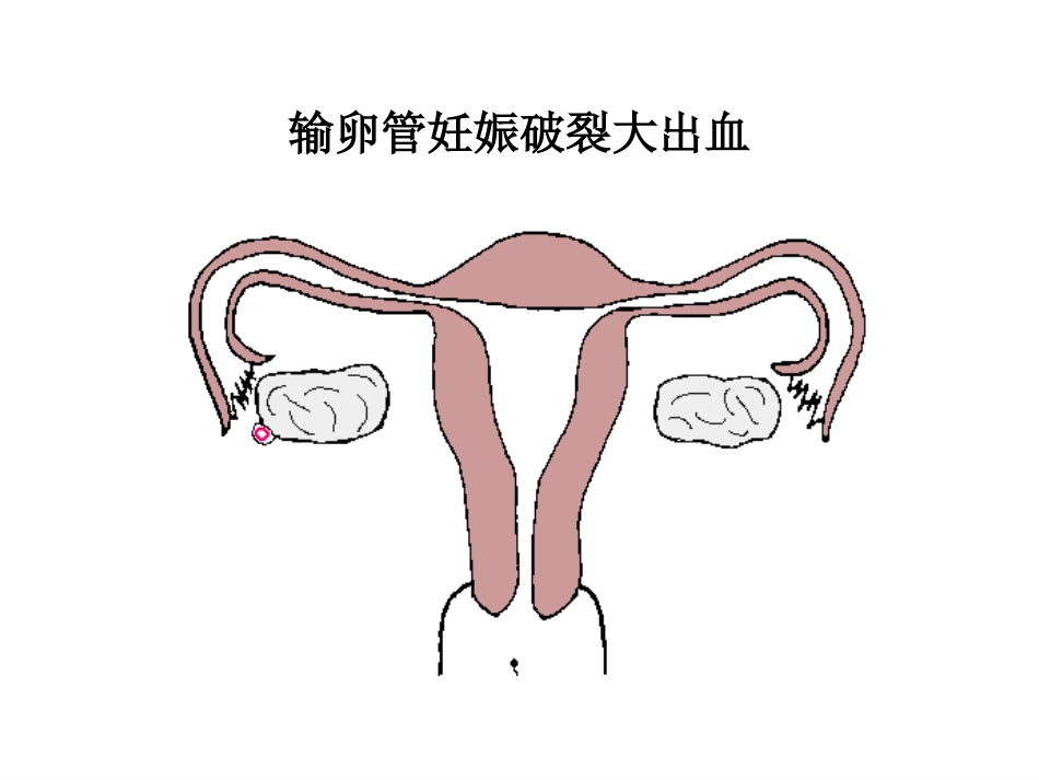 66.产科急救常识复件_第5页