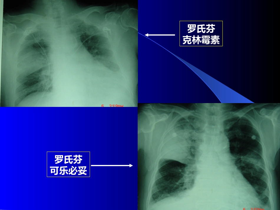 常用急症急救药物的应用医学_第9页