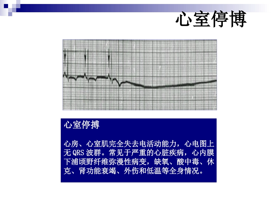 常用急救技术与方法ppt_第10页
