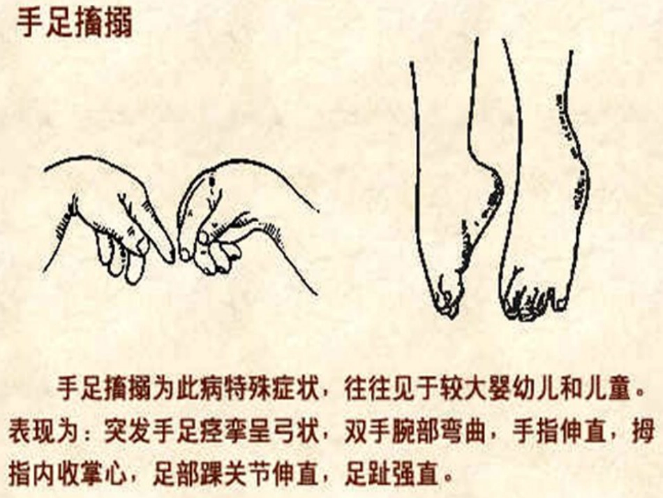 抽搐的急救_第11页