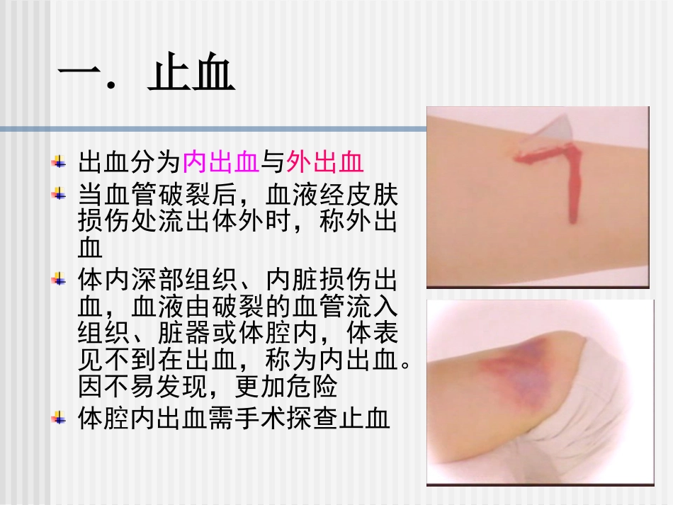 创伤急救四项技术_第8页