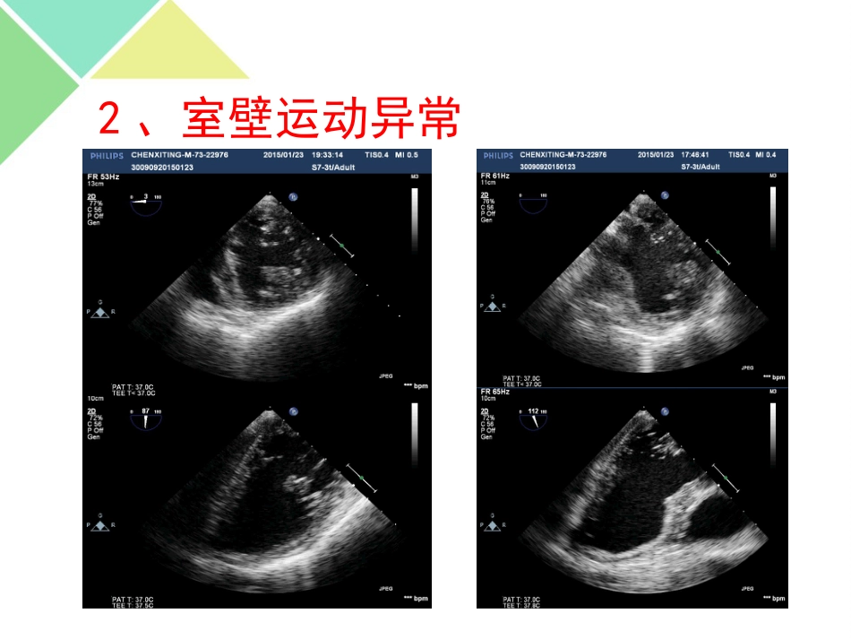 超声可视化技术在急诊急救中的应用_第11页