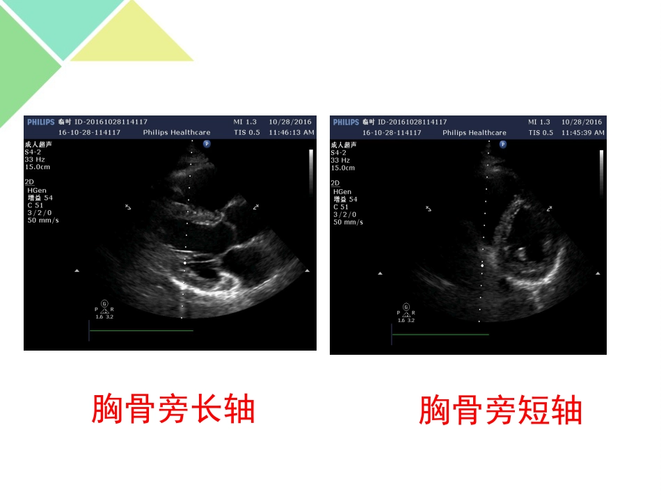 超声可视化技术在急诊急救中的应用_第7页