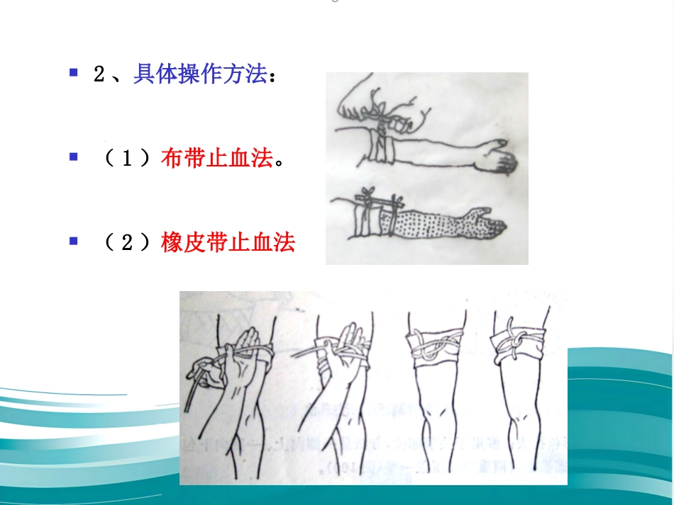 创伤现场急救的四项基本技术_第10页