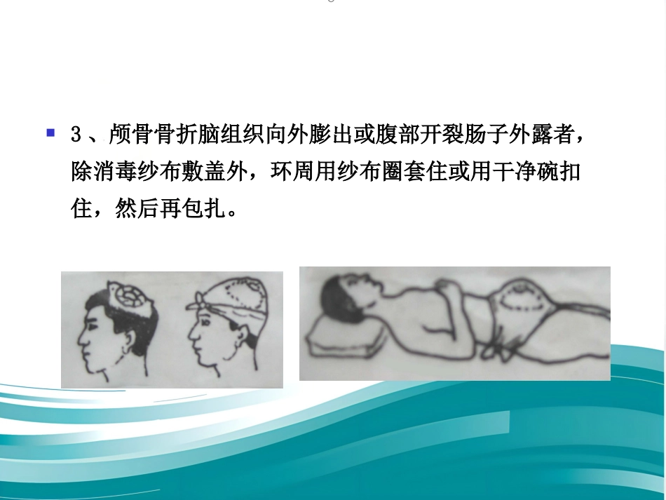 创伤现场急救的四项基本技术_第14页