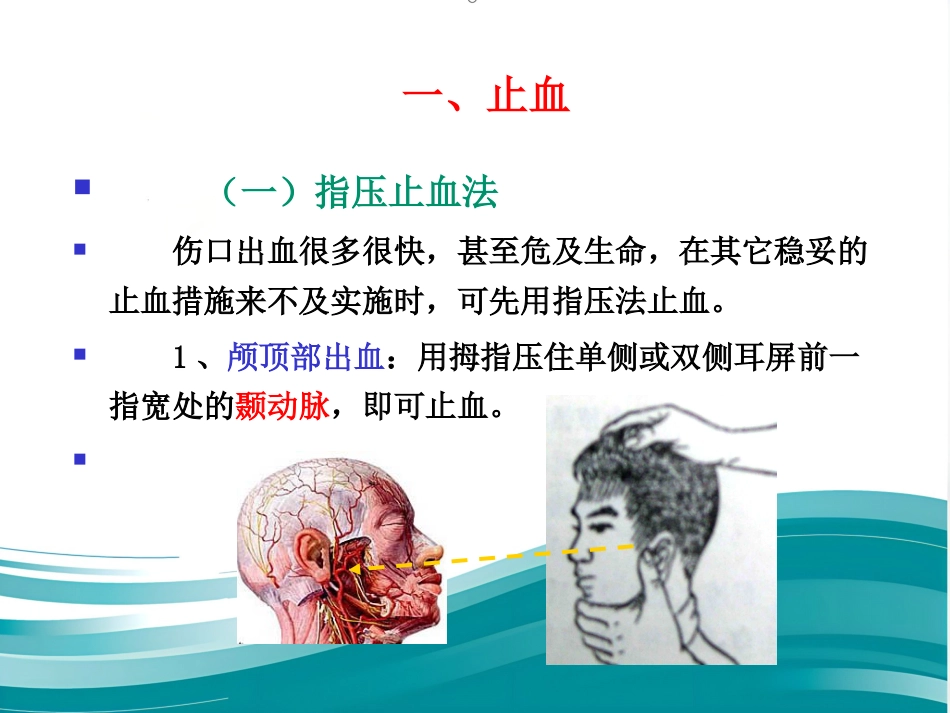 创伤现场急救的四项基本技术_第3页