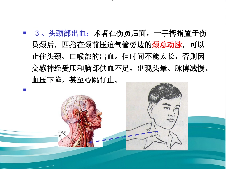 创伤现场急救的四项基本技术_第5页