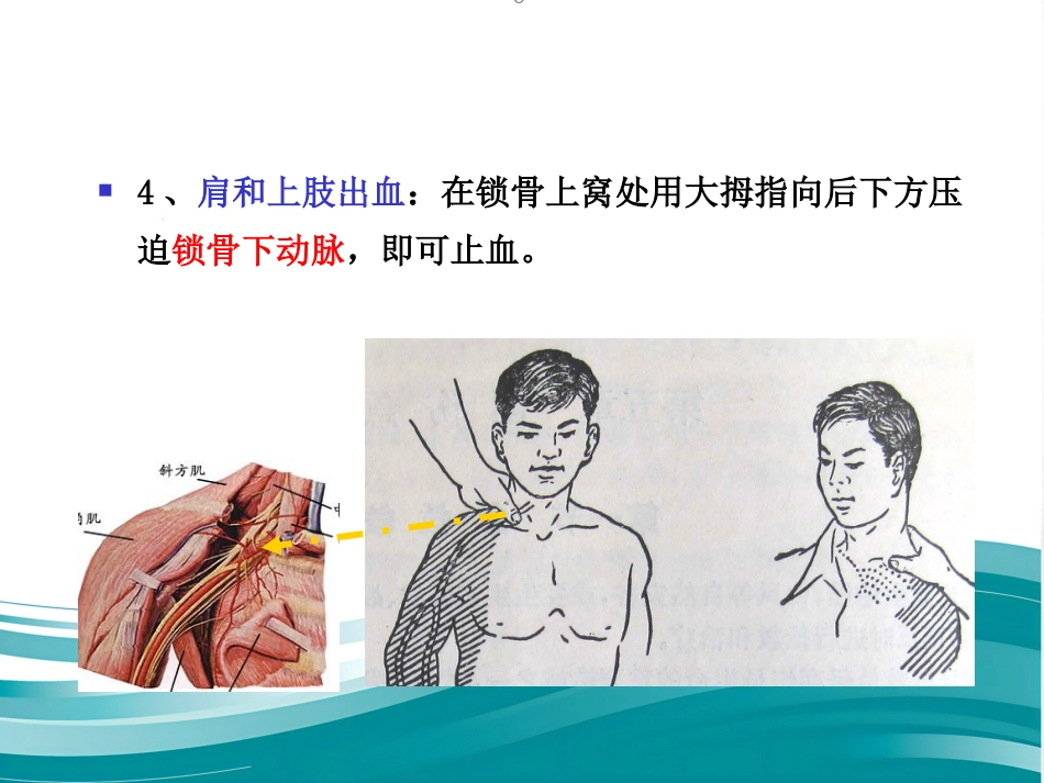 创伤现场急救的四项基本技术_第6页